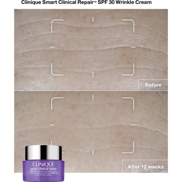 Original Clinique Smart Clinical™ Repair Wrinkle Correcting Cream SPF 30 crema anti-rid SPF 30 75 ml